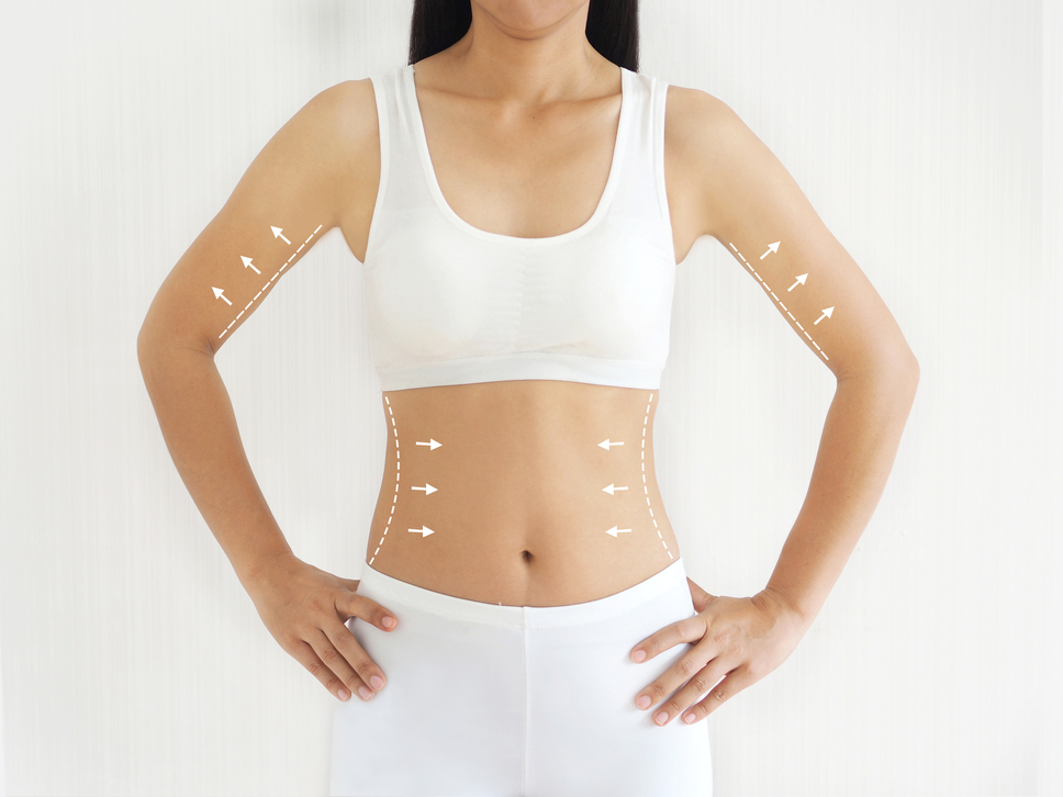 body contouring