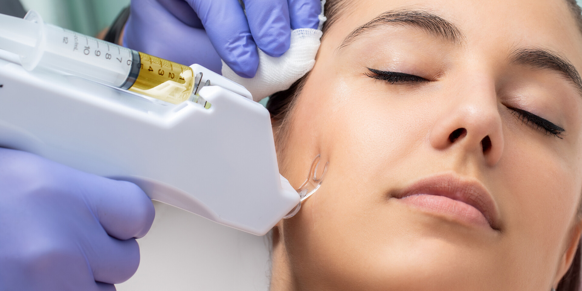 Pigmentation Treatment Dubai