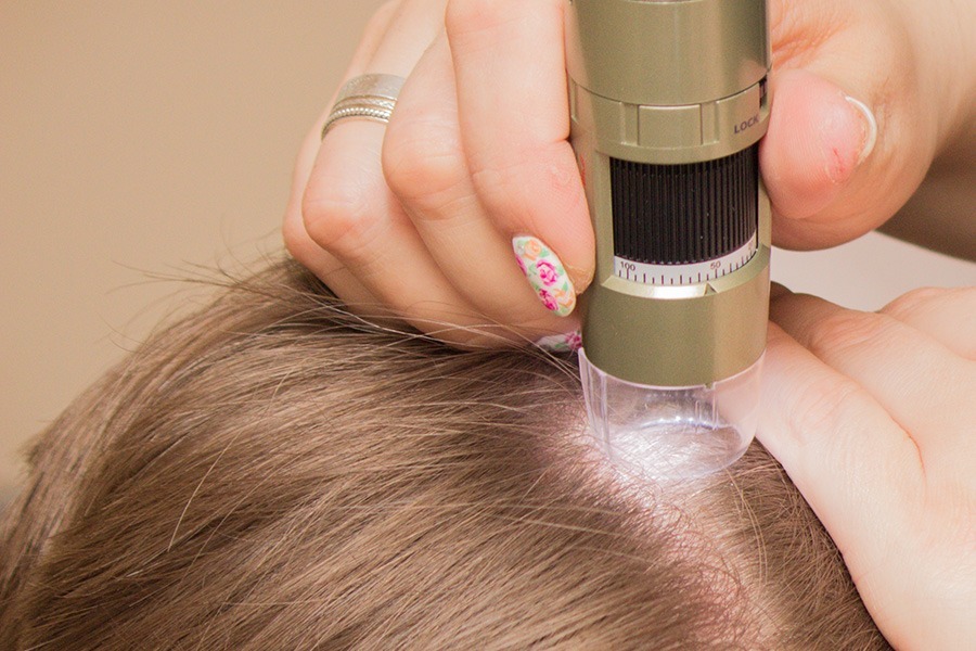 Prp Hair Treatment Dubai